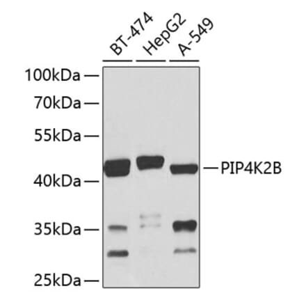 Western Blot - Anti-PIP4K2 beta Antibody (A16039) - Antibodies.com