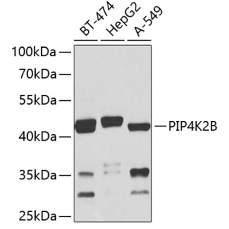 Western Blot - Anti-PIP4K2 beta Antibody (A16039) - Antibodies.com
