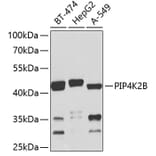 Western Blot - Anti-PIP4K2 beta Antibody (A16039) - Antibodies.com