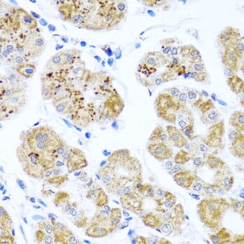 Immunohistochemistry of paraffin-embedded human stomach using Anti-PIP4K2B Antibody (A8016) at dilution of 1:100 (40x lens).