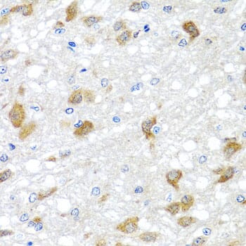 Immunohistochemistry of paraffin-embedded rat brain using Anti-PIP4K2B Antibody (A8016) at dilution of 1:100 (40x lens).