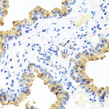 Immunohistochemistry of paraffin-embedded mouse lung using Anti-PIP4K2B Antibody (A8016) at dilution of 1:100 (40x lens).
