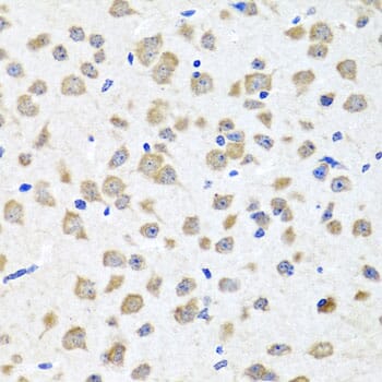 Immunohistochemistry of paraffin-embedded mouse brain using Anti-PIP4K2B Antibody (A8016) at dilution of 1:100 (40x lens).