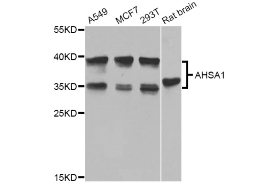 Western Blot - Anti-AHSA1 Antibody (A8018) - Antibodies.com