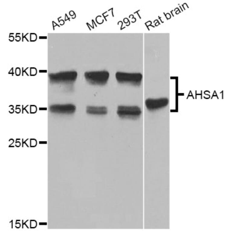 Western Blot - Anti-AHSA1 Antibody (A8018) - Antibodies.com