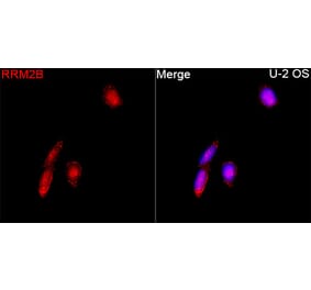 Immunofluorescence - Anti-p53R2 Antibody (A16042) - Antibodies.com