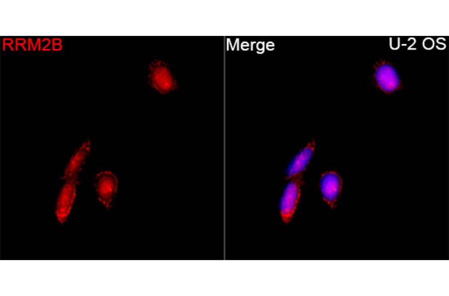 Immunofluorescence - Anti-p53R2 Antibody (A16042) - Antibodies.com