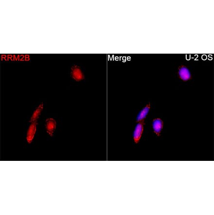 Immunofluorescence - Anti-p53R2 Antibody (A16042) - Antibodies.com