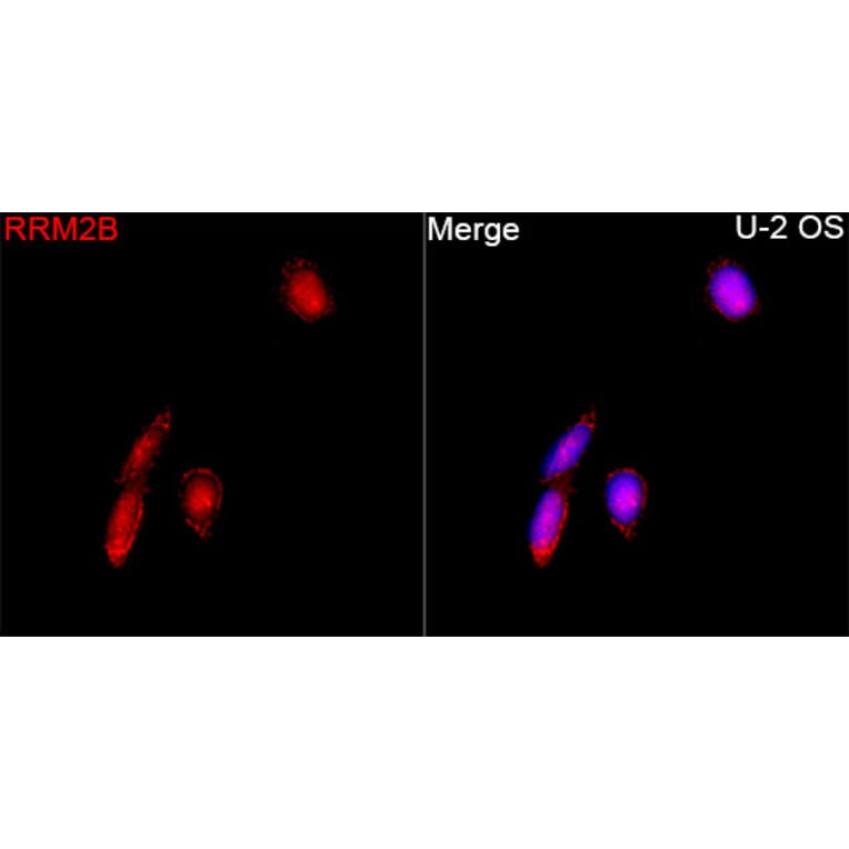 Immunofluorescence - Anti-p53R2 Antibody (A16042) - Antibodies.com
