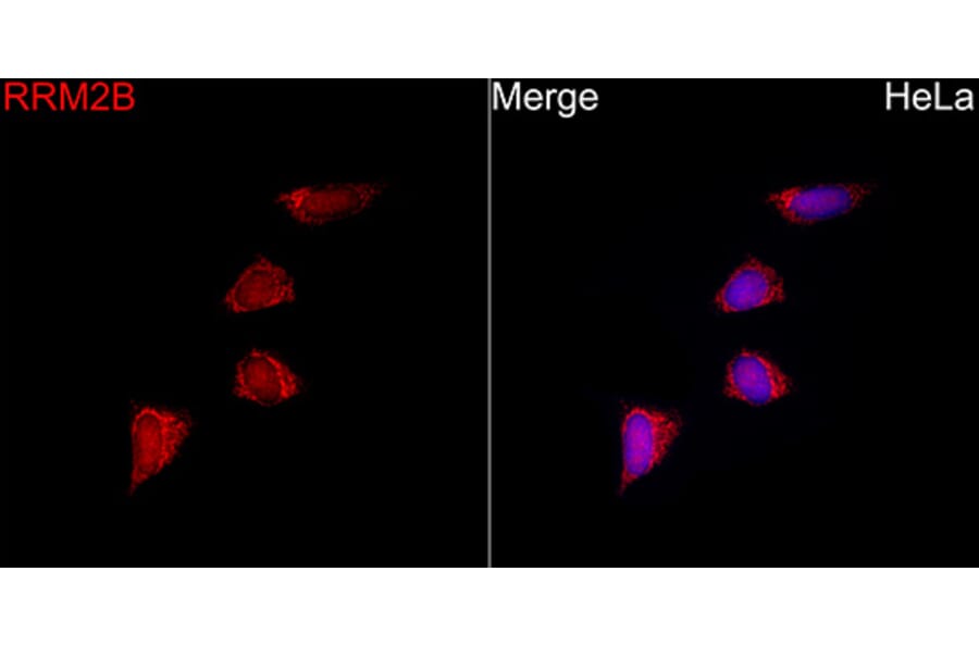 Immunofluorescence - Anti-p53R2 Antibody (A16042) - Antibodies.com