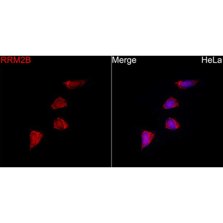 Immunofluorescence - Anti-p53R2 Antibody (A16042) - Antibodies.com
