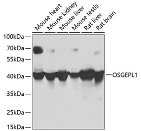Western Blot - Anti-OSGEPL1 Antibody (A16043) - Antibodies.com