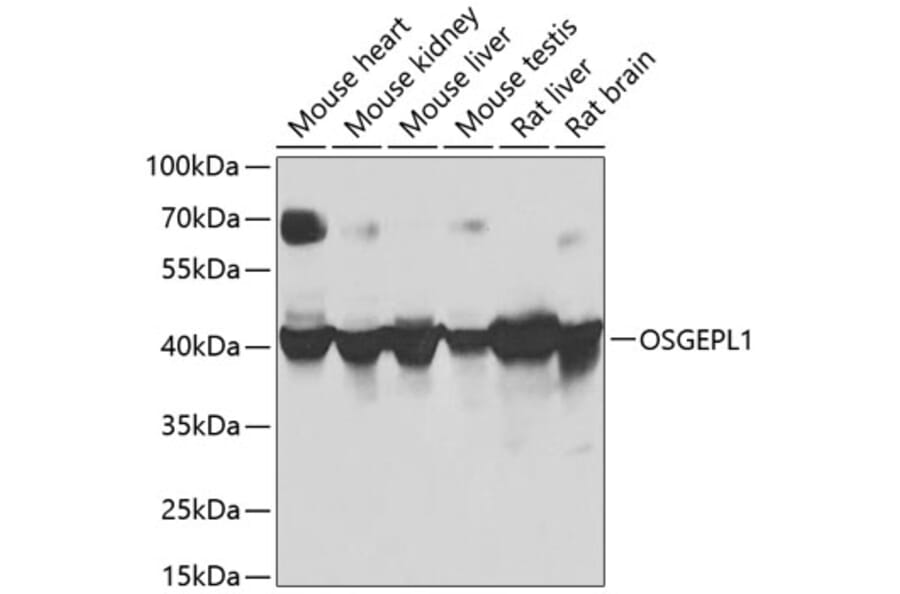 Western Blot - Anti-OSGEPL1 Antibody (A16043) - Antibodies.com