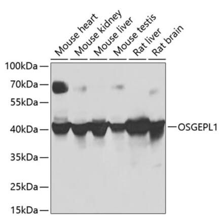 Western Blot - Anti-OSGEPL1 Antibody (A16043) - Antibodies.com