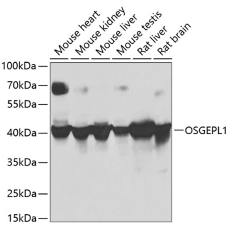 Western Blot - Anti-OSGEPL1 Antibody (A16043) - Antibodies.com