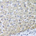 Immunohistochemistry - Anti-OSGEPL1 Antibody (A16043) - Antibodies.com