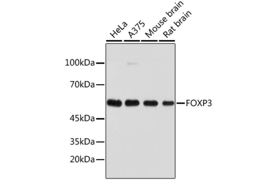Western Blot - Anti-FOXP3 Antibody (A8024) - Antibodies.com