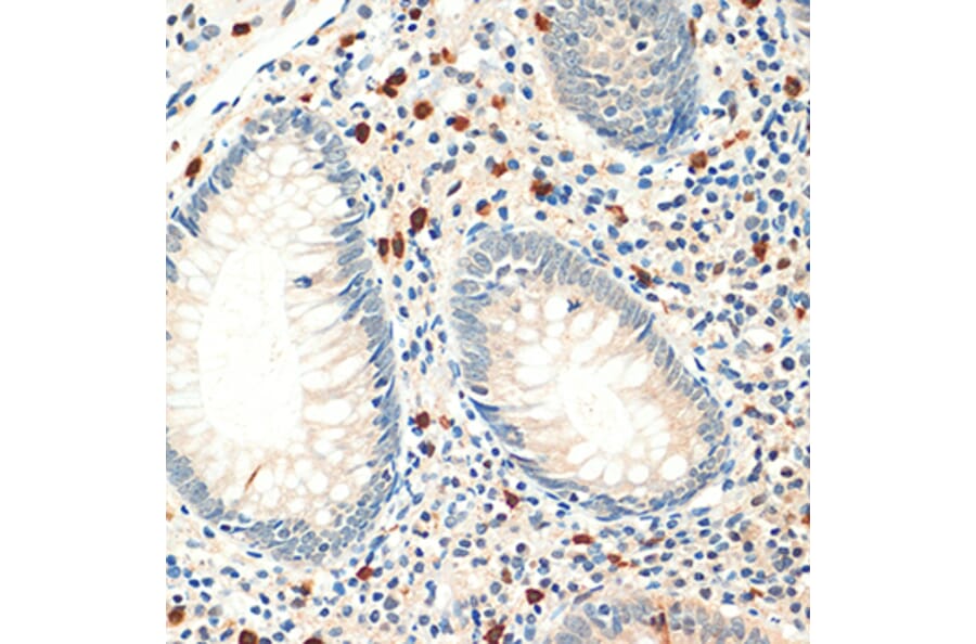 Immunohistochemistry - Anti-FOXP3 Antibody (A8024) - Antibodies.com