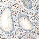 Immunohistochemistry - Anti-FOXP3 Antibody (A8024) - Antibodies.com