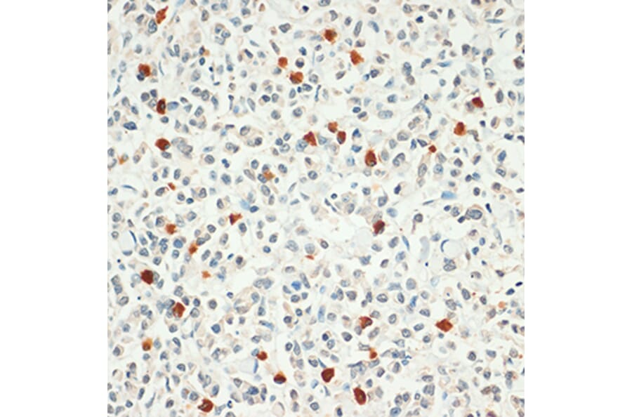 Immunohistochemistry - Anti-FOXP3 Antibody (A8024) - Antibodies.com