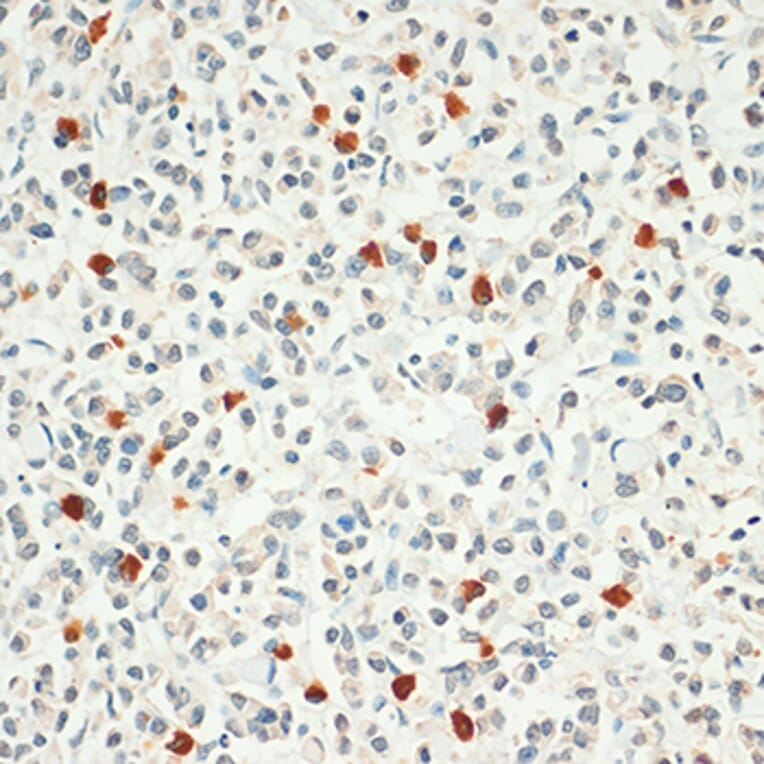 Immunohistochemistry - Anti-FOXP3 Antibody (A8024) - Antibodies.com