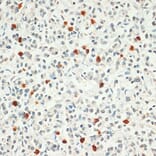 Immunohistochemistry - Anti-FOXP3 Antibody (A8024) - Antibodies.com