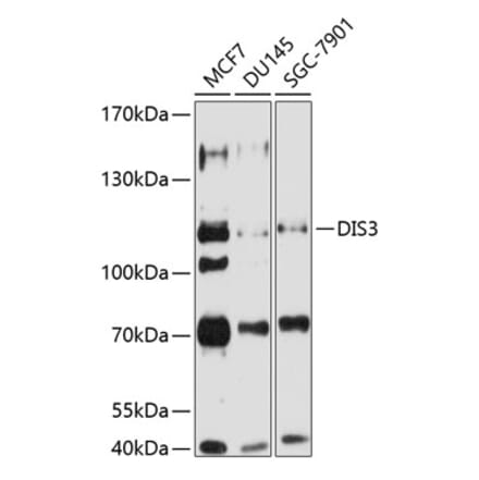 Western Blot - Anti-DIS3 Antibody (A16045) - Antibodies.com