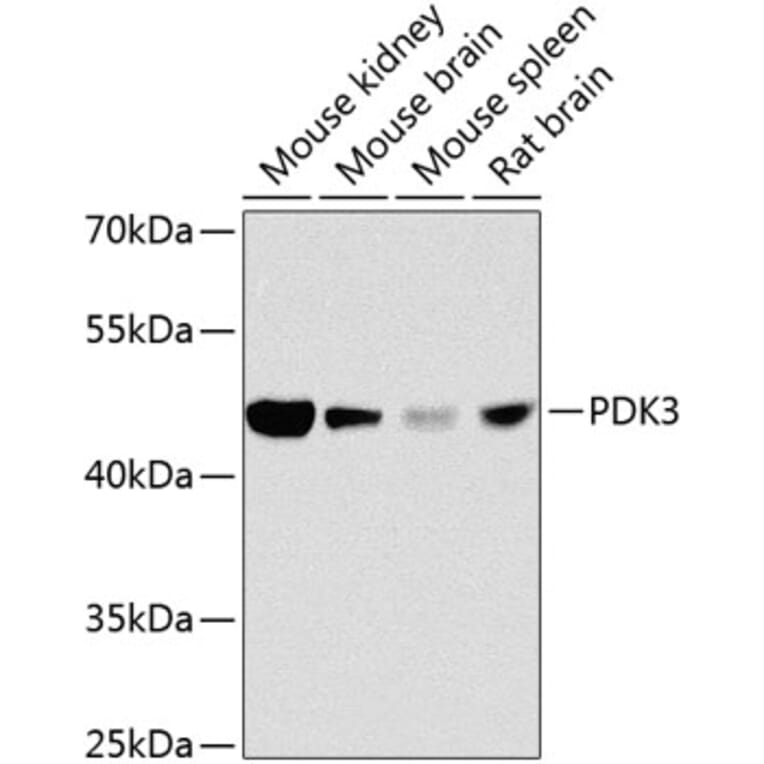 Western Blot - Anti-PDK3 Antibody (A16046) - Antibodies.com