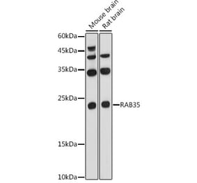 Western Blot - Anti-RAB35 Antibody (A16047) - Antibodies.com