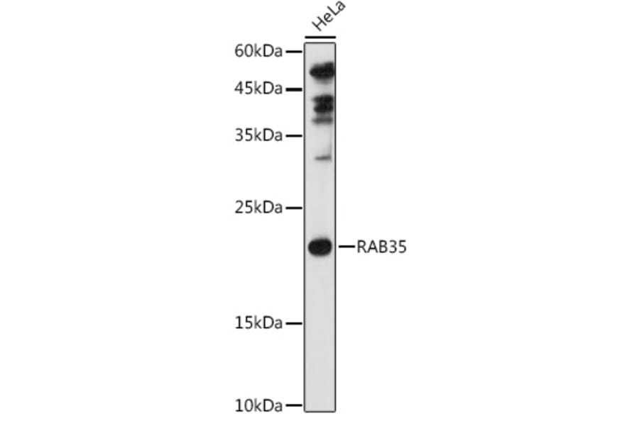 Western Blot - Anti-RAB35 Antibody (A16047) - Antibodies.com