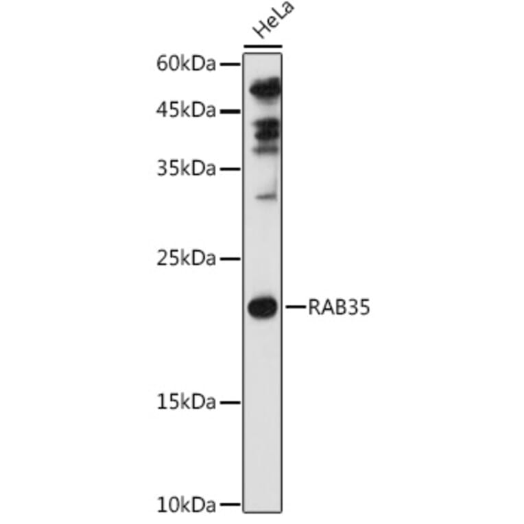 Western Blot - Anti-RAB35 Antibody (A16047) - Antibodies.com