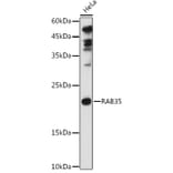 Western Blot - Anti-RAB35 Antibody (A16047) - Antibodies.com