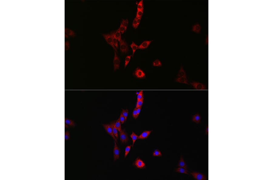 Immunofluorescence - Anti-RAB35 Antibody (A16047) - Antibodies.com