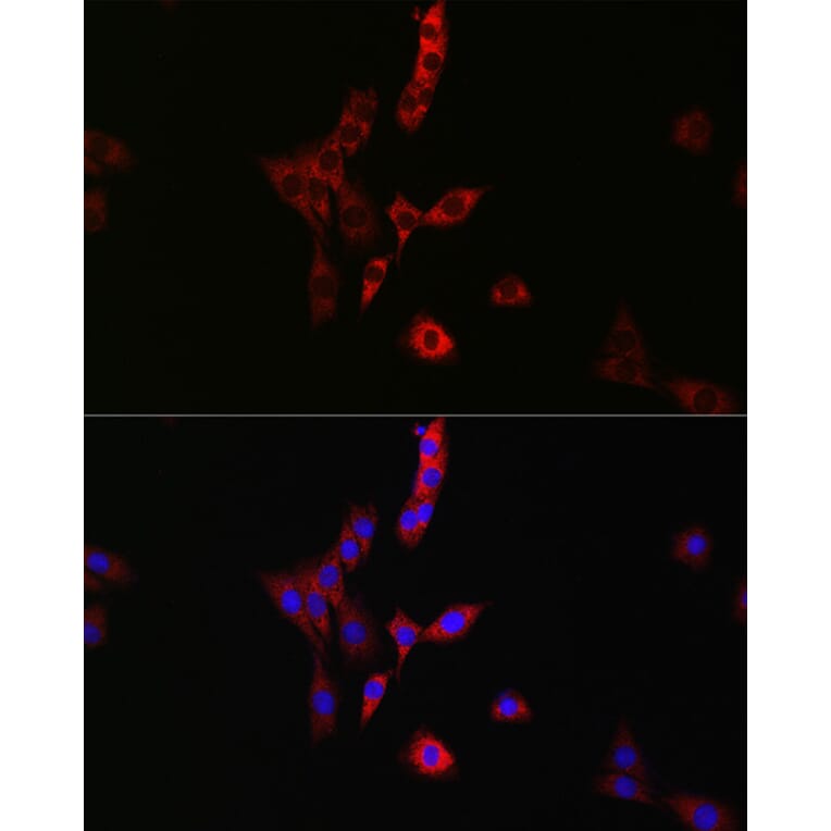 Immunofluorescence - Anti-RAB35 Antibody (A16047) - Antibodies.com