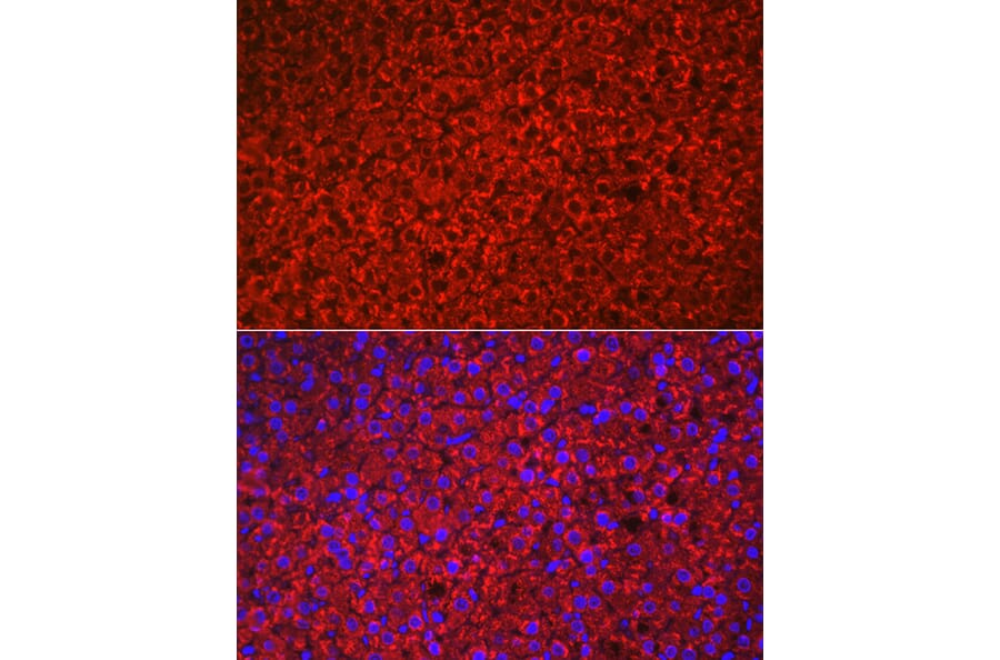 Immunofluorescence - Anti-HSD3B1 Antibody (A16048) - Antibodies.com