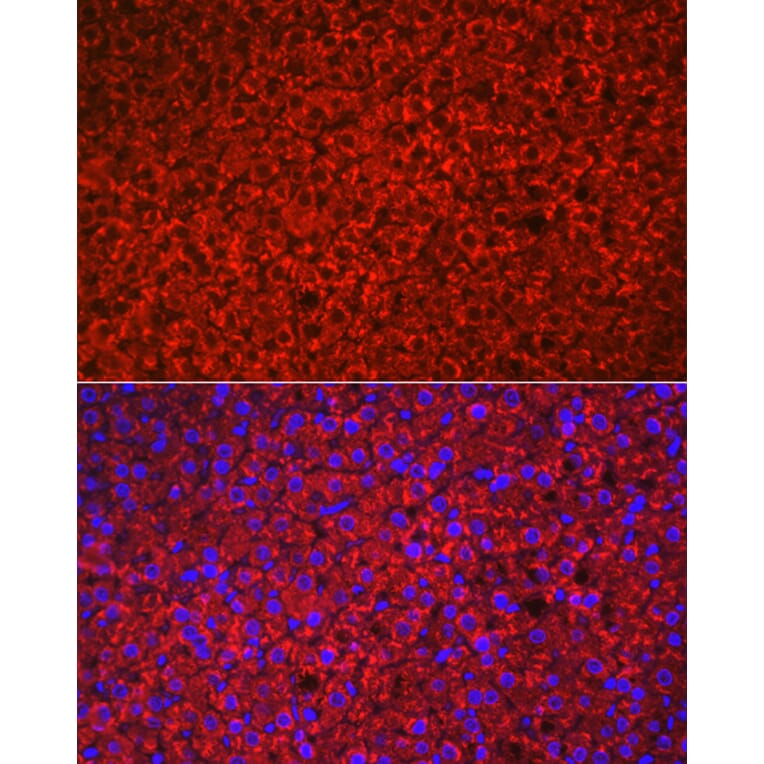 Immunofluorescence - Anti-HSD3B1 Antibody (A16048) - Antibodies.com