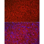 Immunofluorescence - Anti-HSD3B1 Antibody (A16048) - Antibodies.com