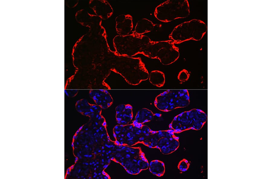 Immunofluorescence - Anti-HSD3B1 Antibody (A16048) - Antibodies.com