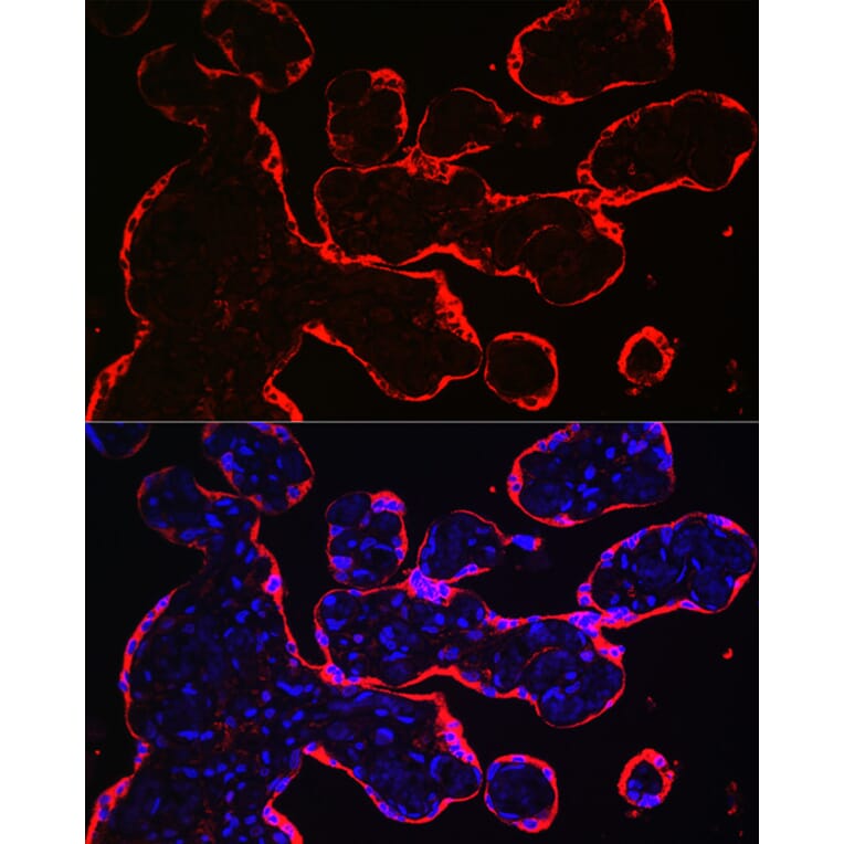 Immunofluorescence - Anti-HSD3B1 Antibody (A16048) - Antibodies.com