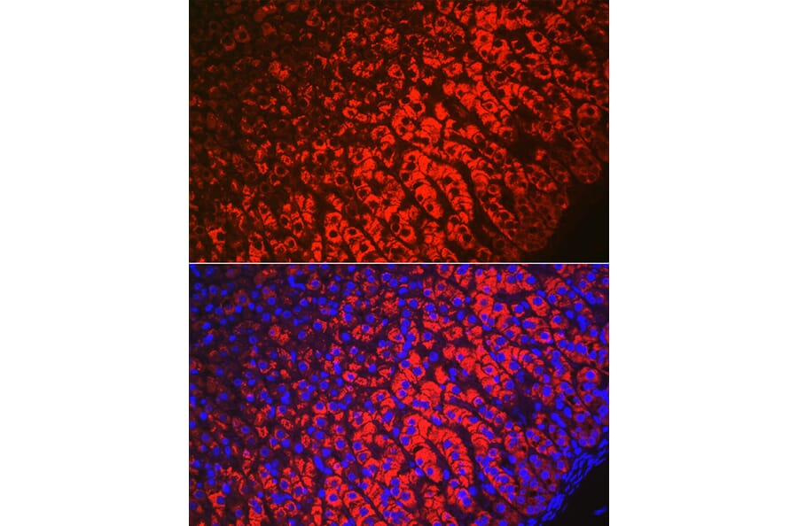 Immunofluorescence - Anti-HSD3B1 Antibody (A16048) - Antibodies.com
