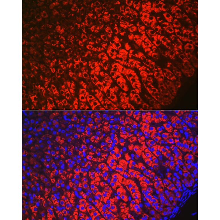 Immunofluorescence - Anti-HSD3B1 Antibody (A16048) - Antibodies.com