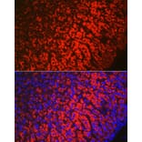 Immunofluorescence - Anti-HSD3B1 Antibody (A16048) - Antibodies.com