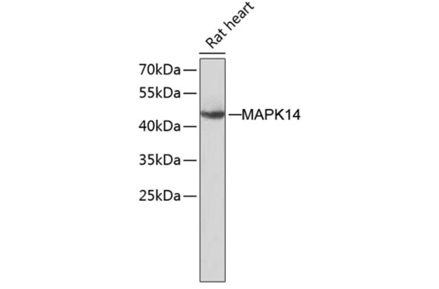 Western Blot - Anti-MAPK14 Antibody (A8038) - Antibodies.com