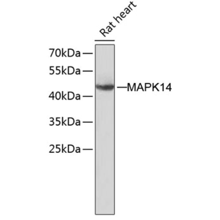Western Blot - Anti-MAPK14 Antibody (A8038) - Antibodies.com