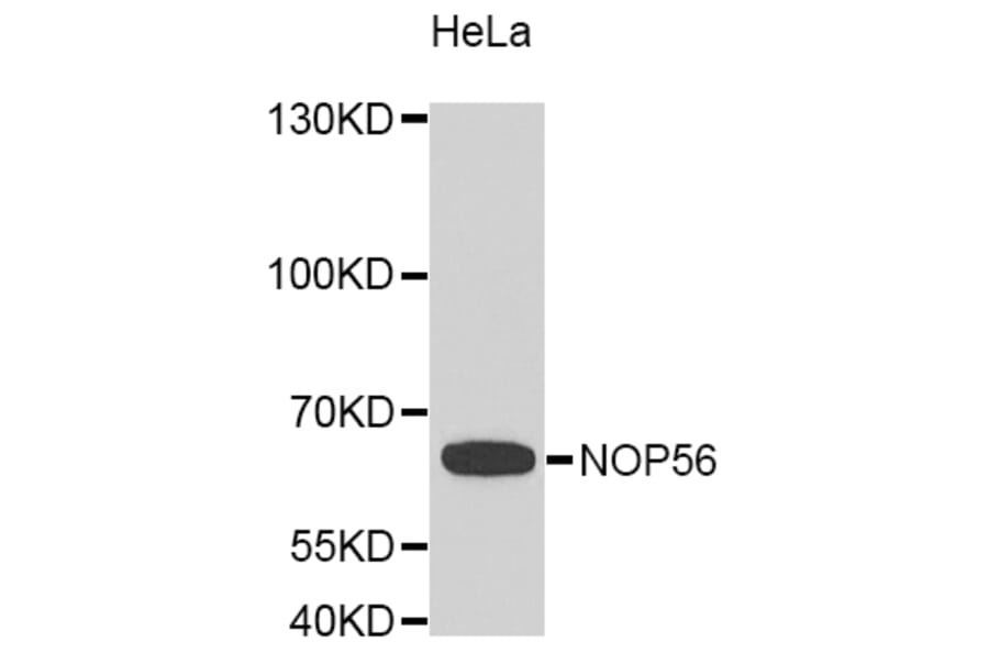 Western Blot - Anti-NOP56 Antibody (A8040) - Antibodies.com