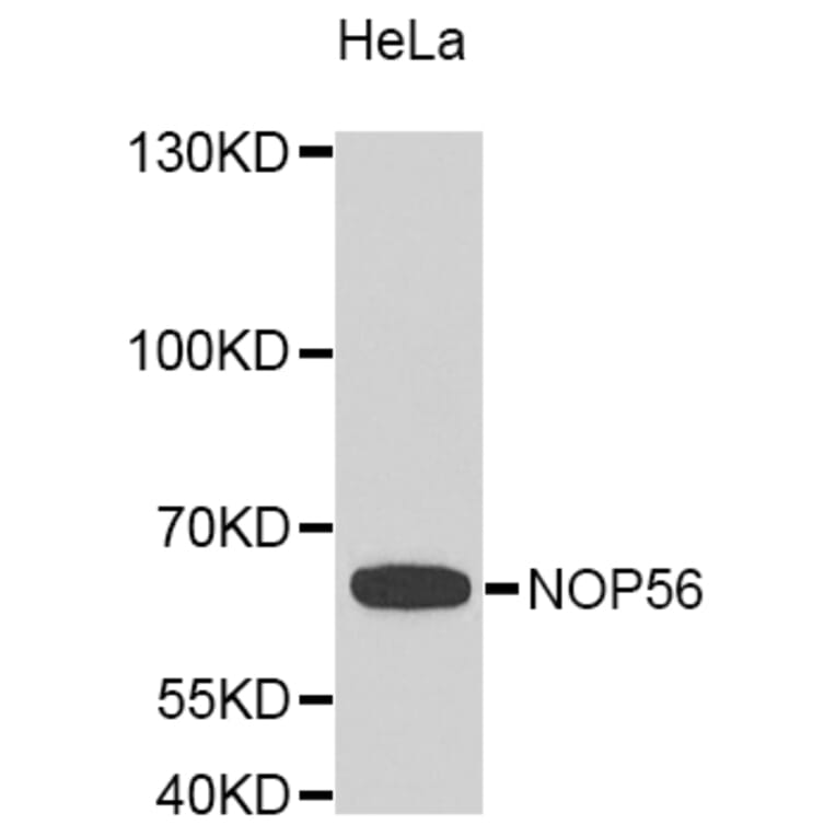 Western Blot - Anti-NOP56 Antibody (A8040) - Antibodies.com
