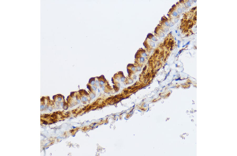 Immunohistochemistry - Anti-Myosin light chain kinase/MLCK Antibody (A16051) - Antibodies.com
