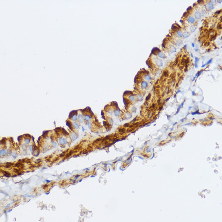 Immunohistochemistry - Anti-Myosin light chain kinase/MLCK Antibody (A16051) - Antibodies.com