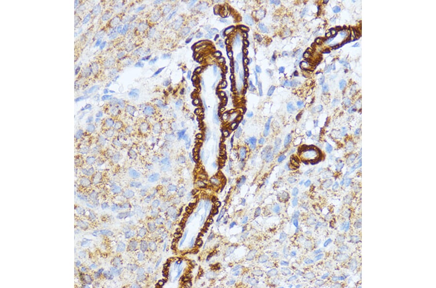 Immunohistochemistry - Anti-Myosin light chain kinase/MLCK Antibody (A16051) - Antibodies.com