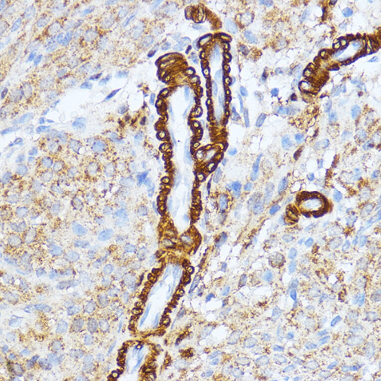 Immunohistochemistry - Anti-Myosin light chain kinase/MLCK Antibody (A16051) - Antibodies.com
